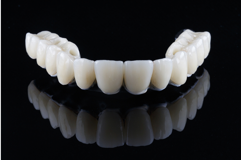 ジルコニアオールセラミック