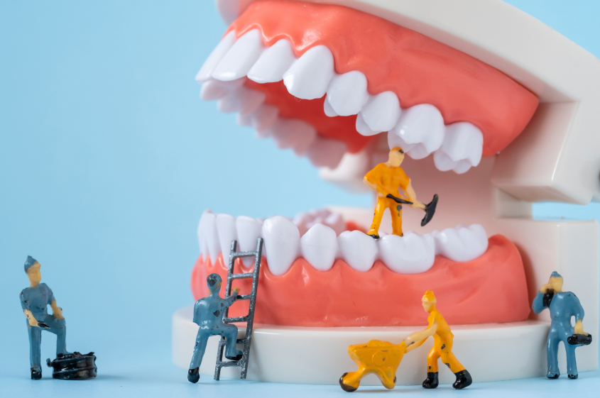 噛み合わせ位置の決定