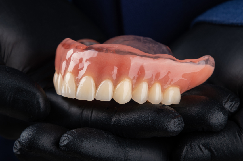 ノンクラスプデンチャー