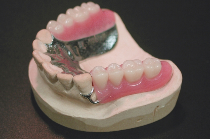 金属床・コバルト床フルプレート