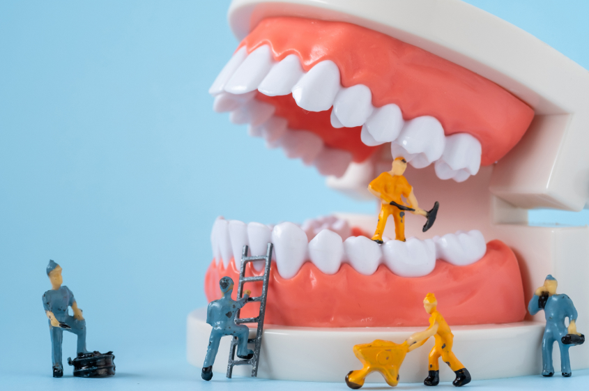 GTR法（組織再生誘導法）