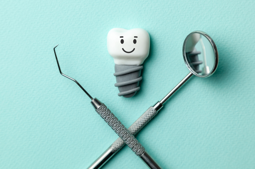 インプラントは、他の歯を守るための「支え」となります