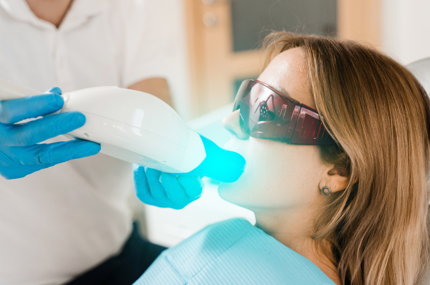 オフィスホワイトニング　